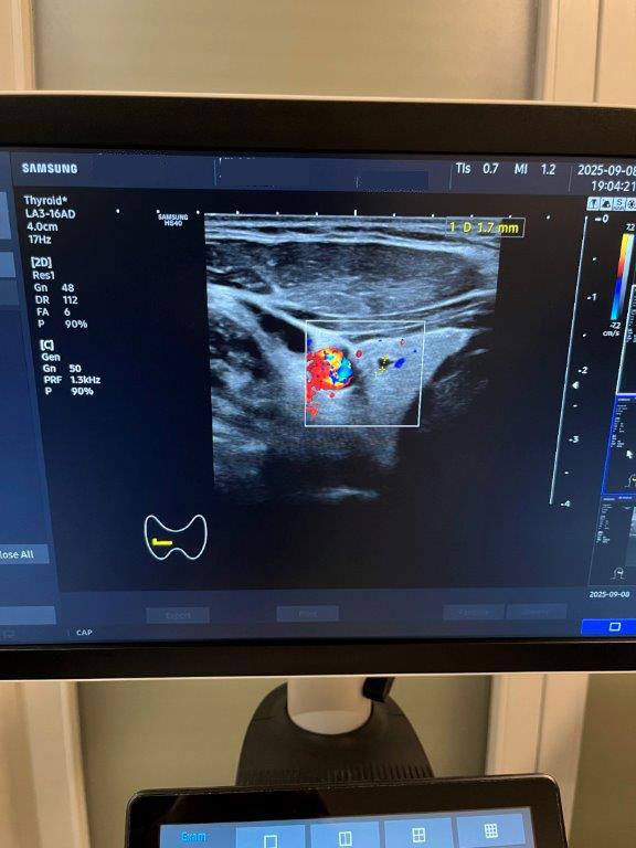 Használt HS40 ultrahang készülék négy vizsgálófejjel szülészeti, nőgyógyászati és radiológiai célra