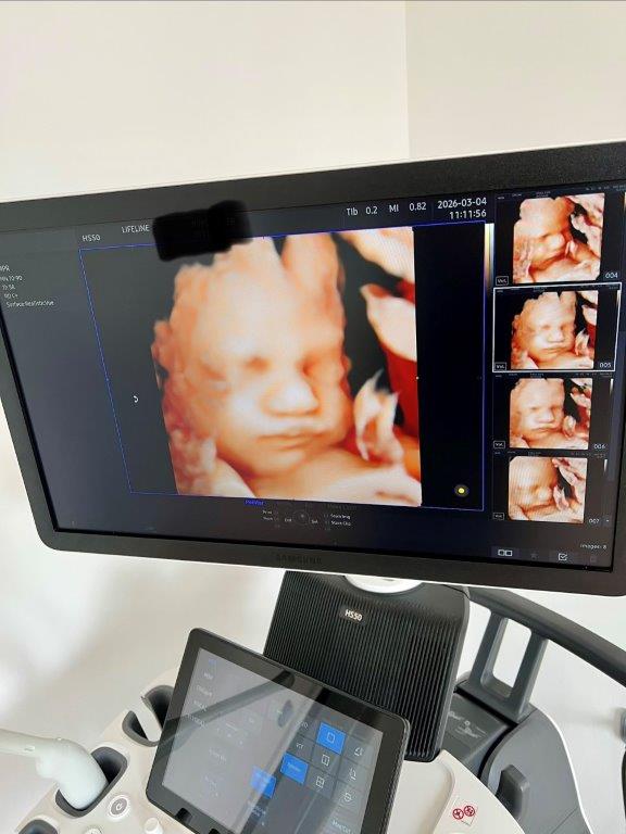 Használt Samsung HS50 típusú 2D/ 3D/ 4D/ 5D ultrahang készülék két vizsgálófejjel