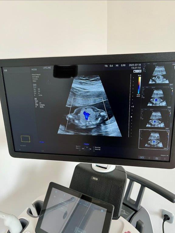 Használt Samsung HS50 típusú 2D/ 3D/ 4D/ 5D ultrahang készülék két vizsgálófejjel