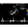 SonoVet R3 hordozható állatorvosi ultrahang kép 3