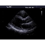 Cardiovascularis ultrahang - Accuvix A30