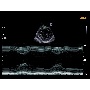 Cardiovascularis ultrahang - Accuvix A30